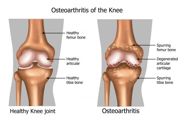Illustration of the knee